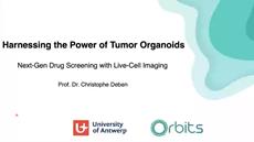 Harnessing the power of tumor organoids: Next-gen drug screening with live-cell imaging